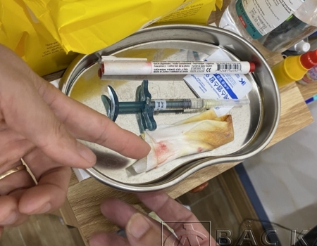 Các dụng cụ tại cơ sở làm đẹp không đảm bảo vệ sinh