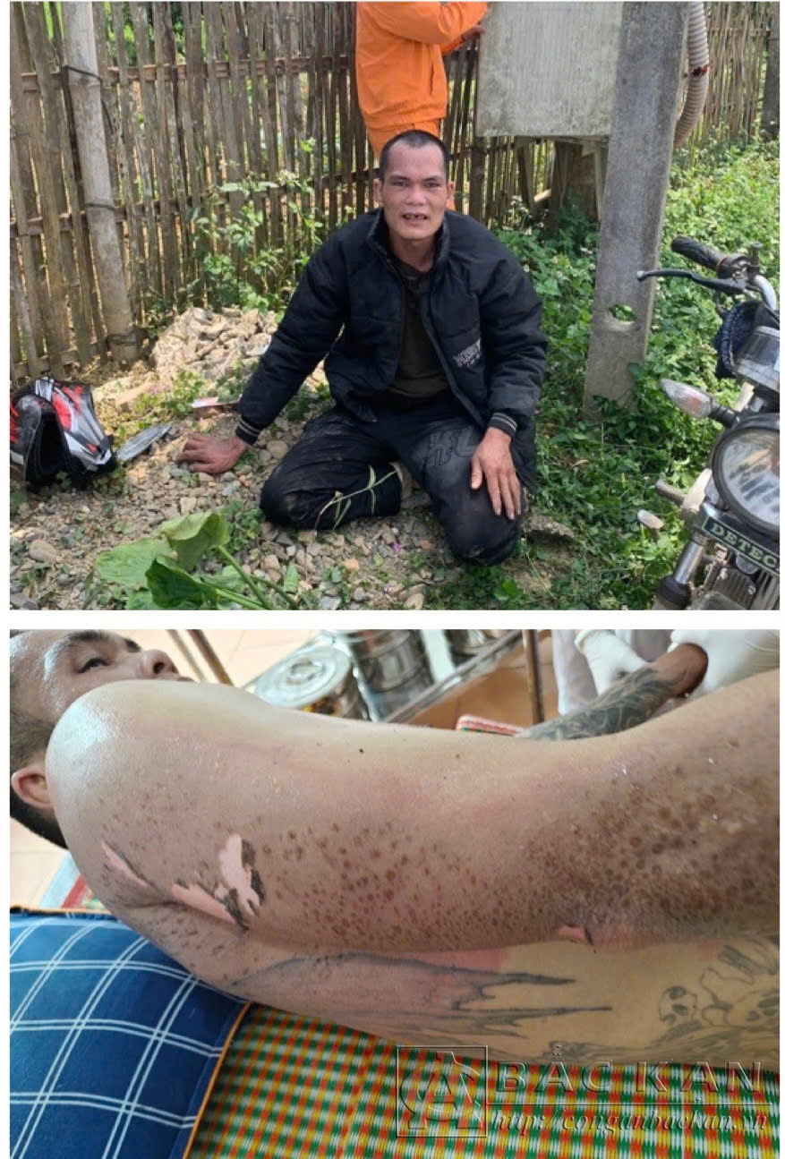 khac điện giật
